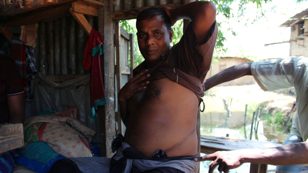 The Bangladesh poor selling organs to pay debts