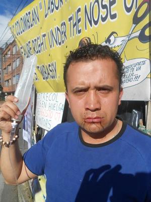 Act Now! General Motors Workers on Hunger Strike in Colombia