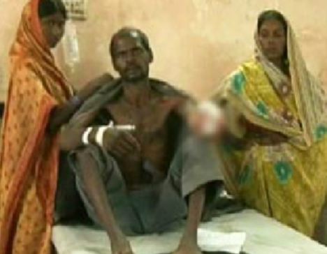 Aliyaar, Indian Laborer, Gets His Hand Chopped Off by his Boss After Asking For $3 in Wages to Feed his Family