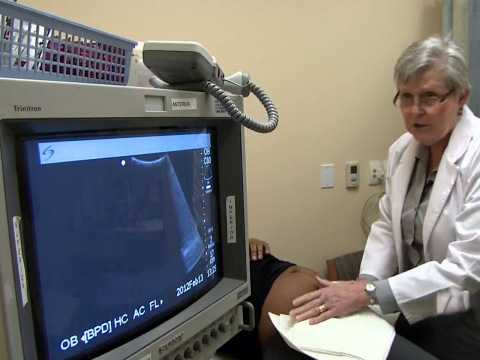 Is a required ultrasound a barrier to abortion?