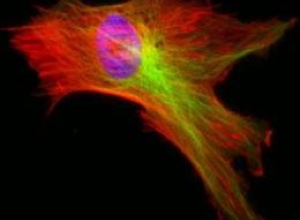 First Stem Cell-Based Therapy Gets Approved – In Canada