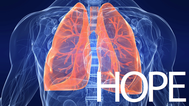 Cuba’s Lung Cancer Vaccine Could Save Your Life